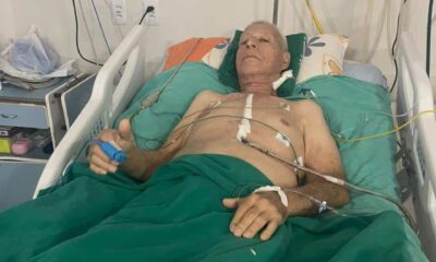 sesau-realiza-primeira-cirurgia-cardiaca-de-alta-complexidade-em-roraima-–-governo-de-roraima